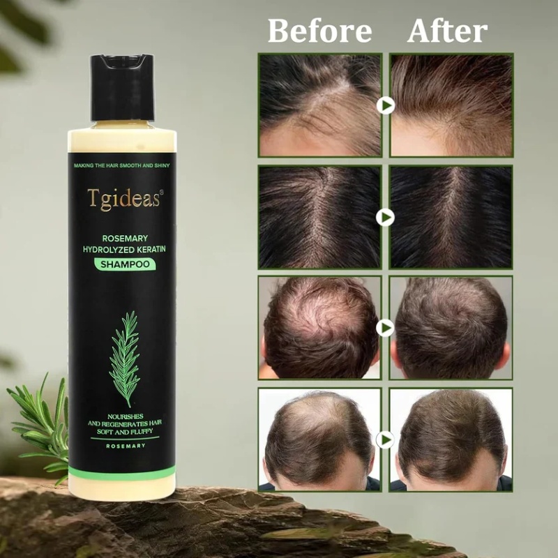 Novalys — Rosemary Shampoo | Hair Growth & Scalp Treatment